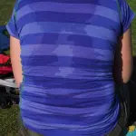 Sudorazione abbondante: un problema che si può prevenire