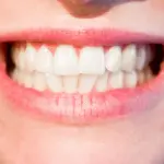 Business dei denti bianchi: si va sempre più in cerca di soluzioni